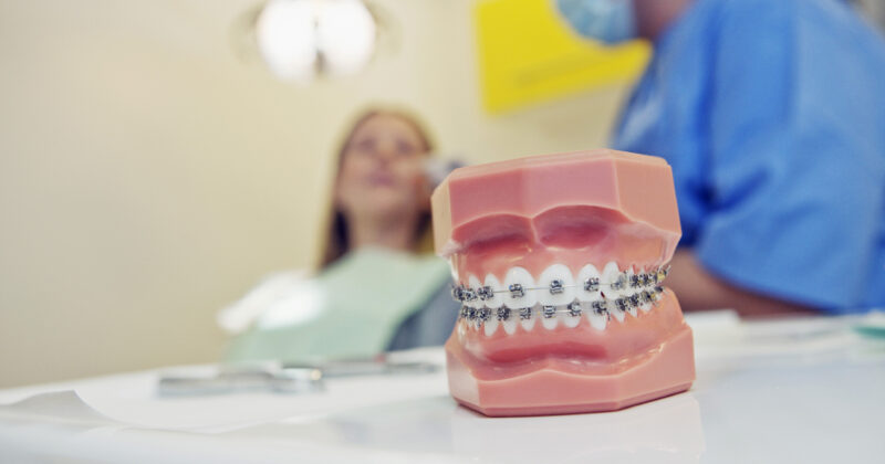 A dentist specialized in orthodontics is examining a model of braces, which can be showcased on their website designs.